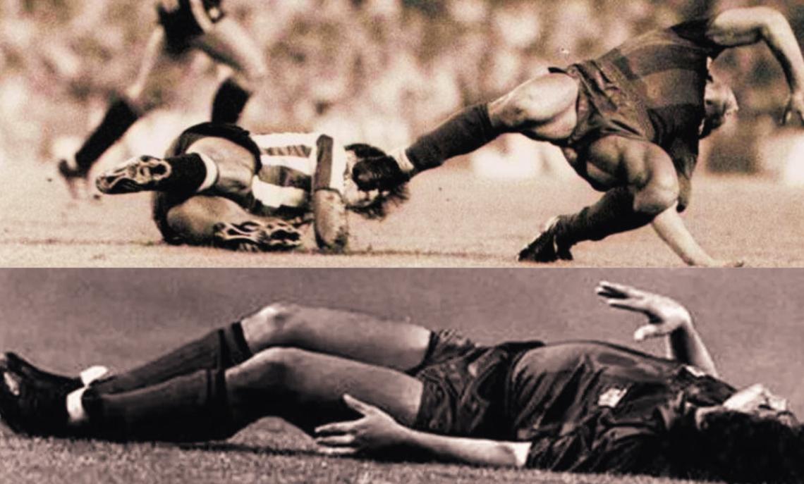 Il fallo di Goikoetxea su Maradona