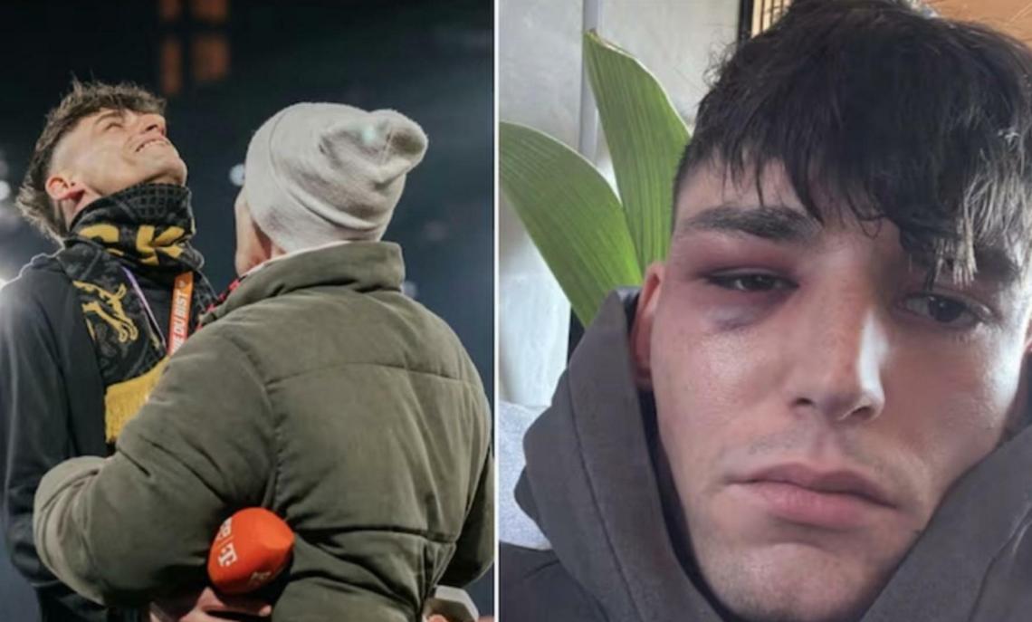 L'aggressione a Pascal Kaiser dopo il s&igrave; che ha commosso la Bundesliga