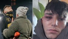 L'aggressione a Pascal Kaiser dopo il s&igrave; che ha commosso la Bundesliga