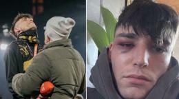 L'aggressione a Pascal Kaiser dopo il s&igrave; che ha commosso la Bundesliga