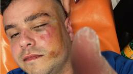 Mega rissa tra calciatori, influencer e spettatori: sospesa la finale di Naples League